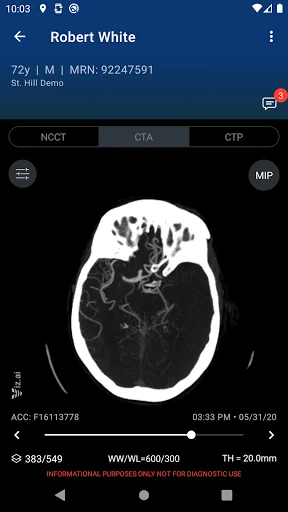 Viz.ai