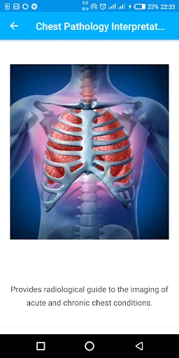 A-Z Chest XRay Pathology Guide