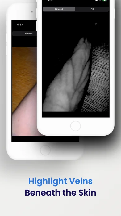 VeinSeek Pro