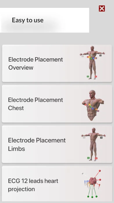 3D ECG Leads