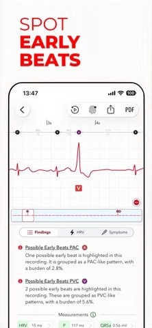 EKG+ | Dein Watch-EKG-Leser