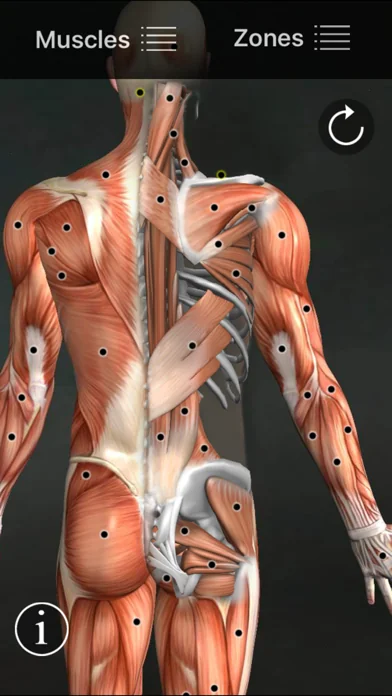 Muscle Trigger Points