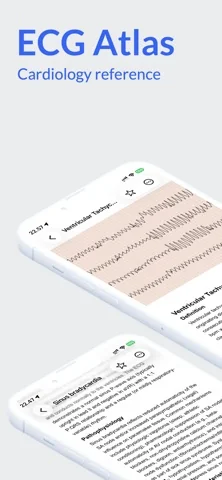 ECG Atlas