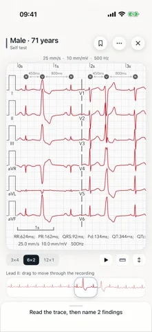 EKG für Ärzte